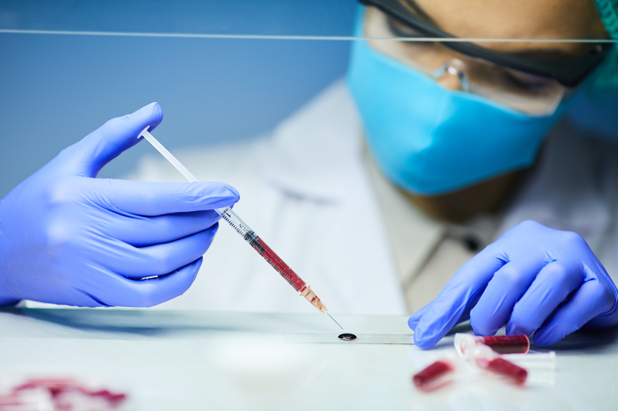Blood Tests
